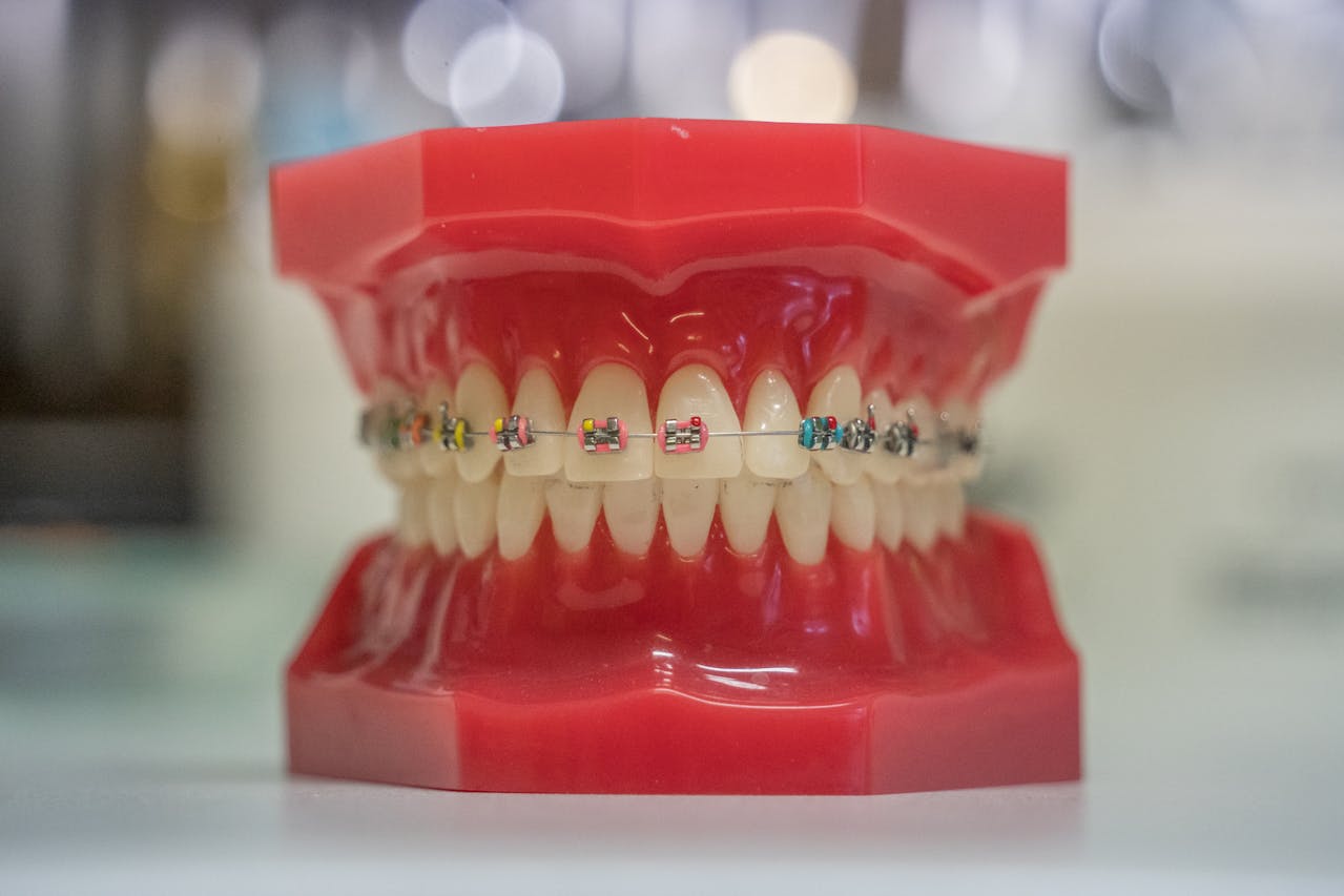 Dental model with colorful braces by Keller & Wainwright Orthodontics in Sunnyvale, CA