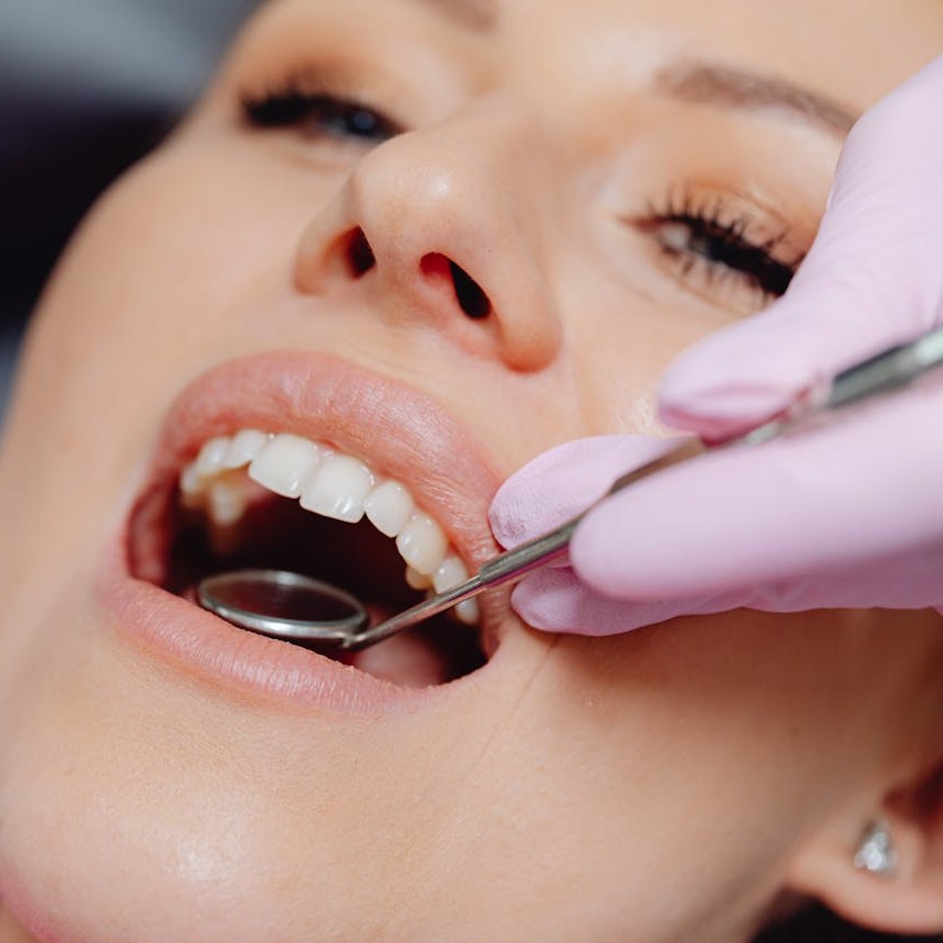 Close-up of dental checkup at Keller & Wainwright Orthodontics in Sunnyvale, CA